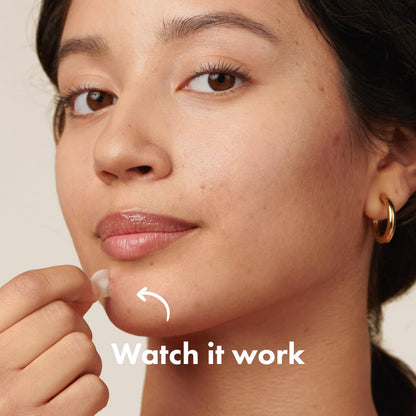 Mighty Patch™ Original Patch from  – the #1 Hydrocolloid Acne Pimple Patch for Shrinking Zits and Whiteheads in 1 Use; Nighttime Spot Stickers for Face and Skin (72 Count)